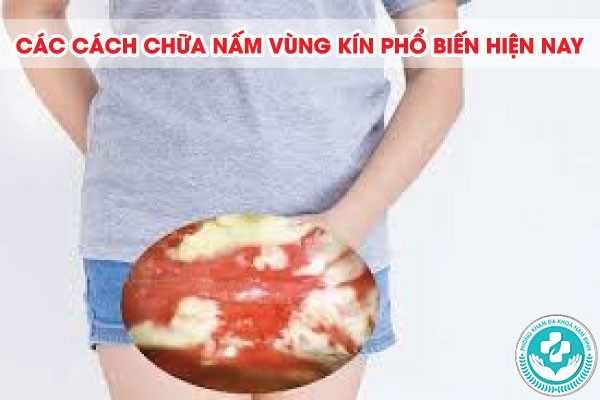 cách chữa nấm vùng kín