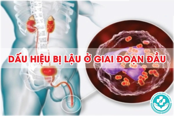 dấu hiệu bị lậu