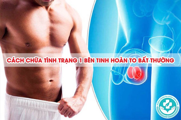 1 bên tinh hoàn to bất thường