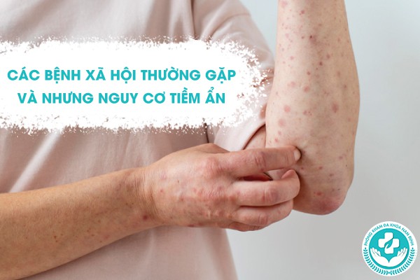 các bệnh xã hội thường gặp