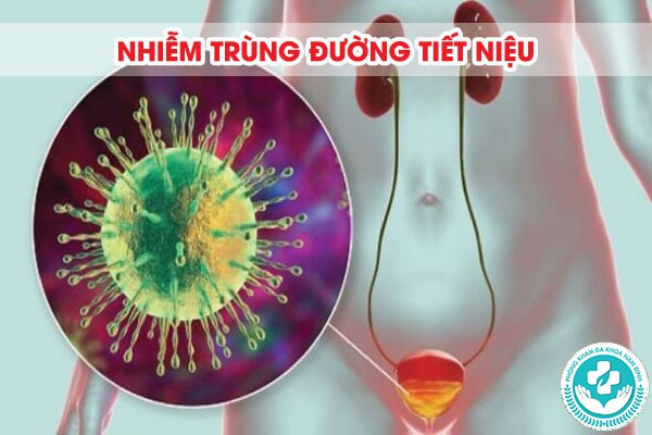 bao quy đầu có mùi hôi bao quy đầu có mùi hôi