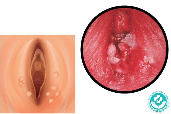 bên trong cửa mình có cục thịt