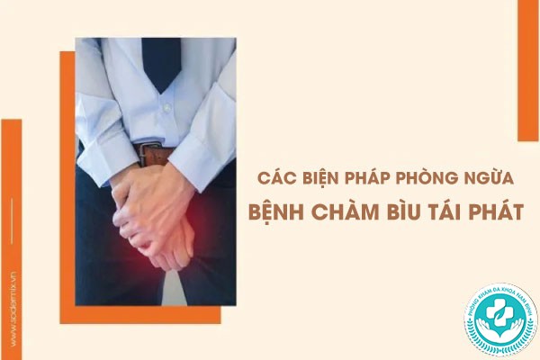 Chàm bìu Chàm bìu