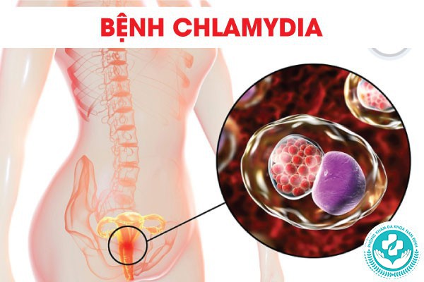 bệnh Chlamydia có chữa khỏi được không