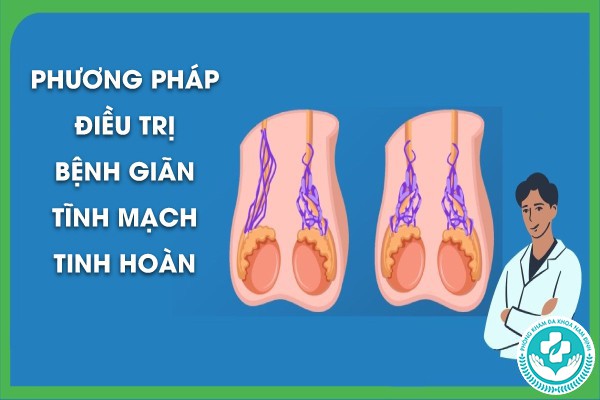 bệnh giãn tĩnh mạch tinh hoàn