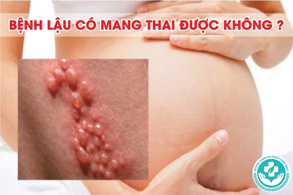 bệnh lậu có mang thai được không