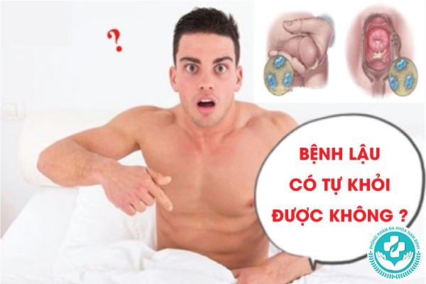 bệnh lậu có tự khỏi được không