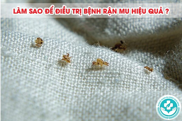 bệnh rận mu