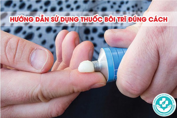 bệnh trĩ bôi thuốc gì