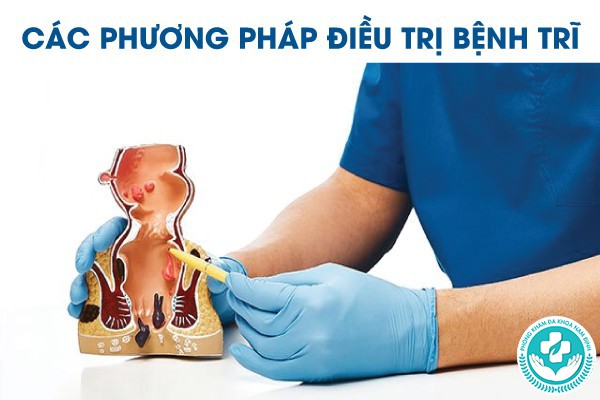 bệnh trĩ là bệnh nội khoa hay ngoại khoa