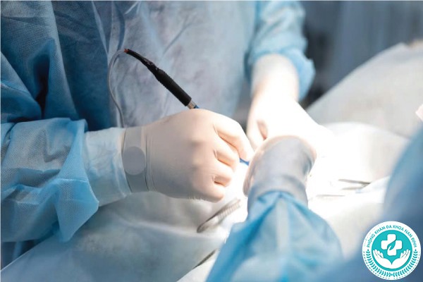 bệnh trĩ ngoại có chữa được không