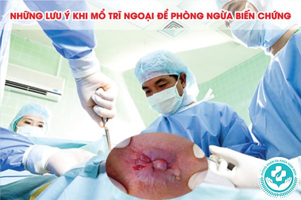 bệnh trĩ ngoại có nên mổ không