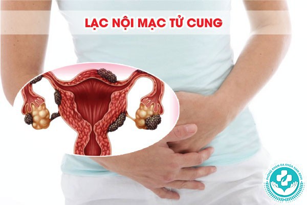 bị đau bụng dưới âm ỉ ở nữ