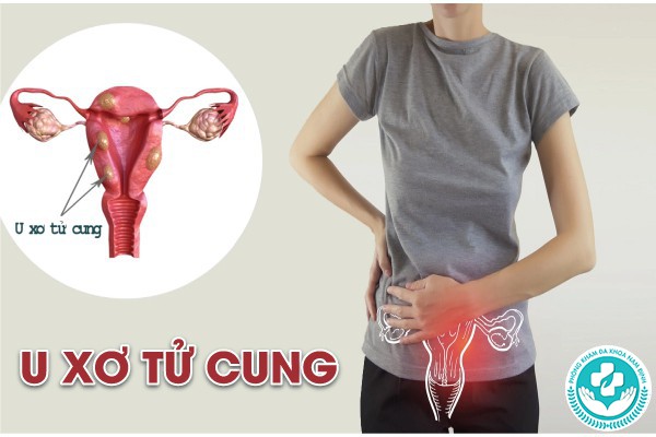 bị đau bụng dưới ở nữ có phải mang thai