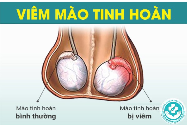 đau buốt khi tiểu tiện