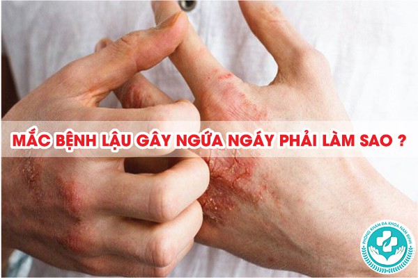 bị lậu có ngứa không