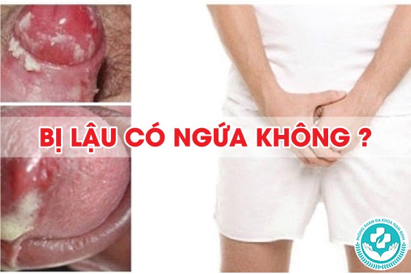 bị lậu có ngứa không