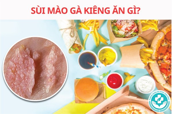 bị sùi mào gà kiêng ăn gì