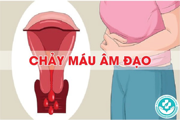 biểu hiện viêm nhiễm phụ khoa