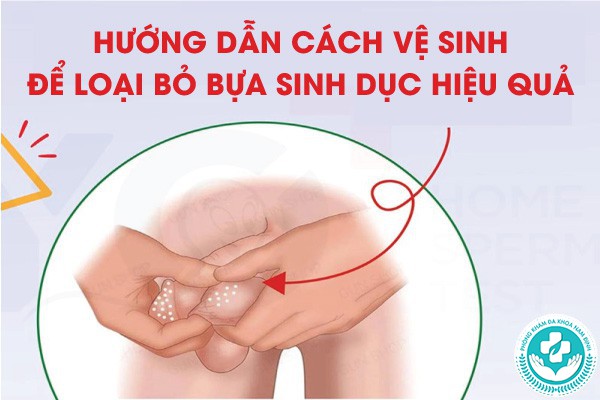 bựa sinh dục