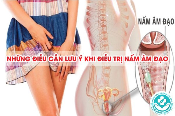 cách điều trị nấm âm đạo