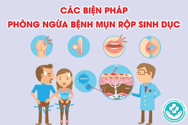 cách nhận biết mụn rộp sinh dục