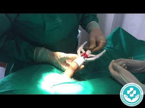 Cắt bao quy đầu ở Thanh Hóa
