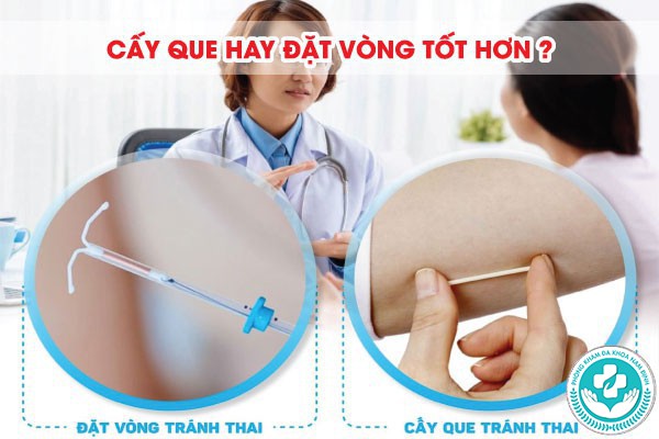 Cấy que tránh thai Nam Định