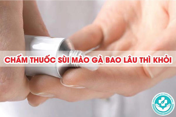 chấm thuốc sùi mào gà bao lâu thì khỏi