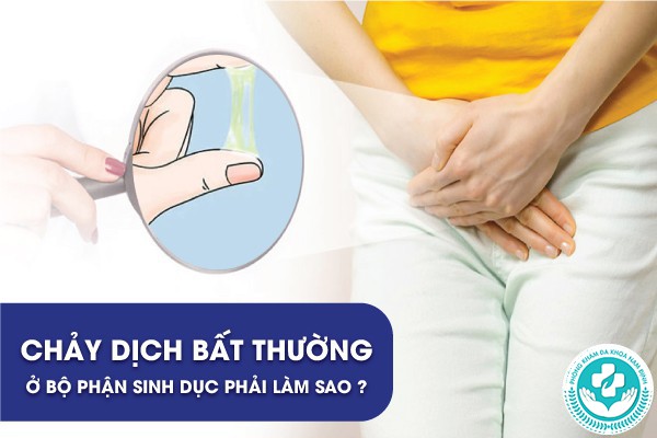 chảy dịch bất thường ở bộ phận sinh dục