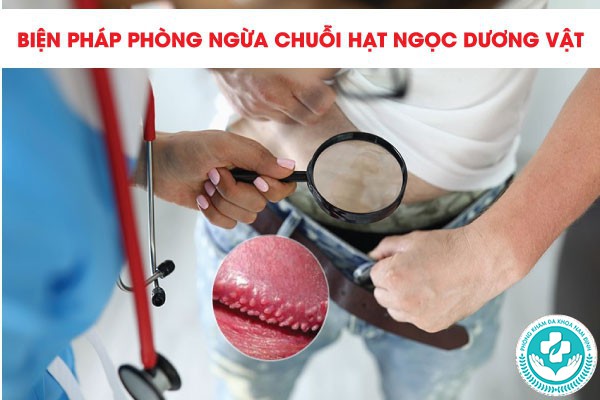 Chi phí điều trị chuỗi hạt ngọc Chi phí điều trị chuỗi hạt ngọc