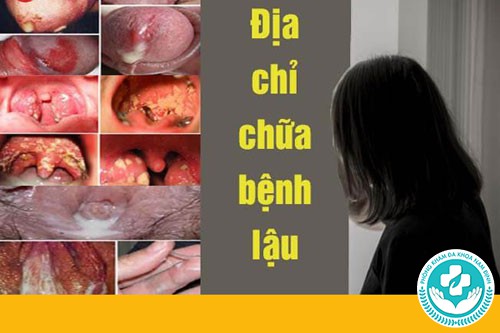 chữa bệnh lậu ở hà nam