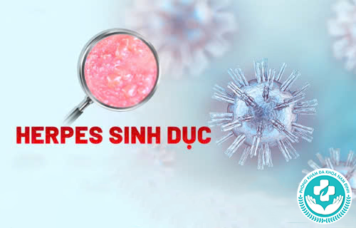 chữa mụn rộp sinh dục tại hà nam chữa mụn rộp sinh dục tại hà nam
