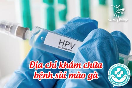 chữa sùi mào gà ở hà nam