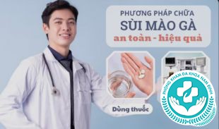 Chữa sùi mào gà ở Hòa Bình