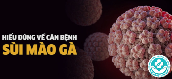 Chữa sùi mào gà ở Thanh Hóa Chữa sùi mào gà ở Thanh Hóa