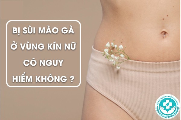 chữa sùi mào gà ở vùng kín nữ