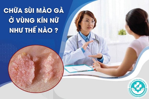 chữa sùi mào gà ở vùng kín nữ