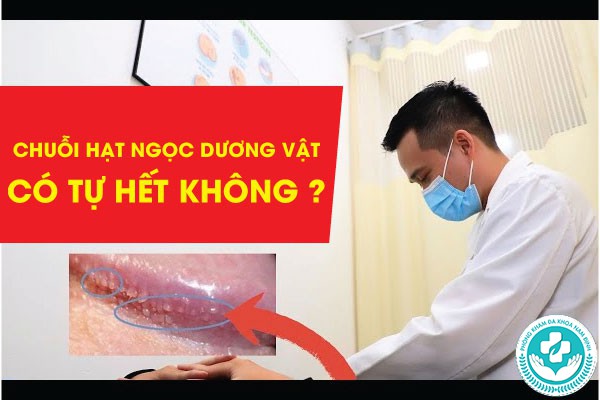 chuỗi hạt ngọc dương vật có tự hết không