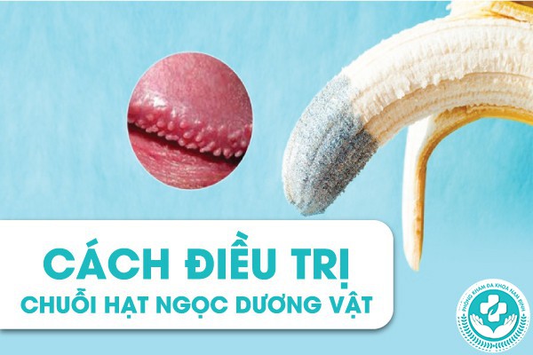 chuỗi hạt ngọc dương vật
