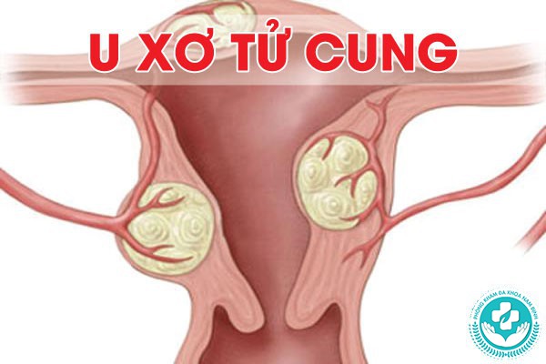Chướng bụng dưới có phải mang thai