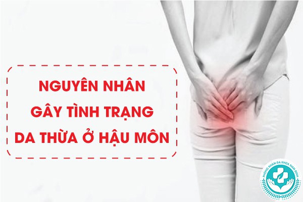 da thừa ở hậu môn