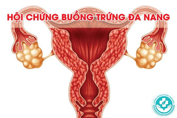 đau bụng dưới âm i nhưng không có kinh