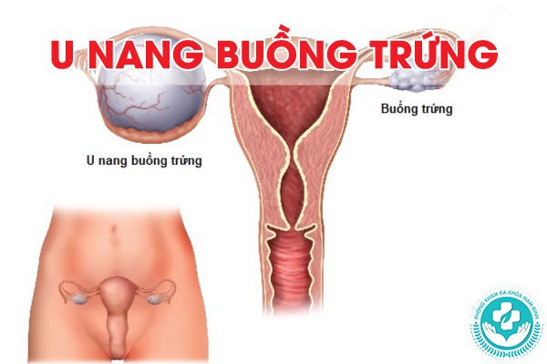 đau bụng dưới và ra máu sau khi quan hệ