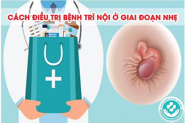 dấu hiệu bệnh trĩ nội nhẹ