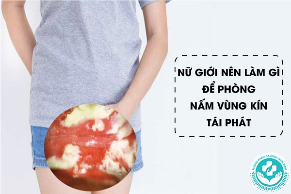 dấu hiệu của nấm vùng kín