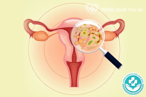 dấu hiệu nhận biết bị viêm vùng kín