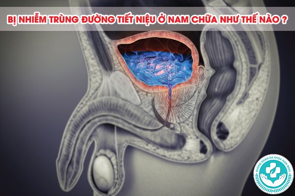 Dấu hiệu nhiễm trùng đường tiết niệu ở nam