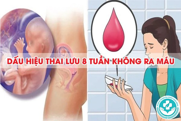 dấu hiệu thai lưu 8 tuần không ra máu