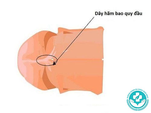 dây hãm dương vật bị rách dây hãm dương vật bị rách
